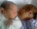 Cặp sinh đôi chào đời ở 2 quốc gia