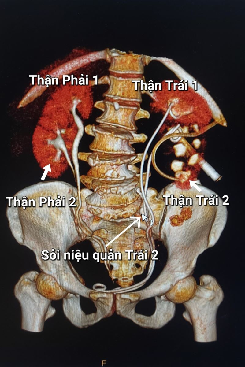 benhhocnam.com