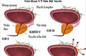 Khi bạn bị ung thư tuyến tiền liệt bạn vẫn có thể điều trị khỏi hoàn toàn